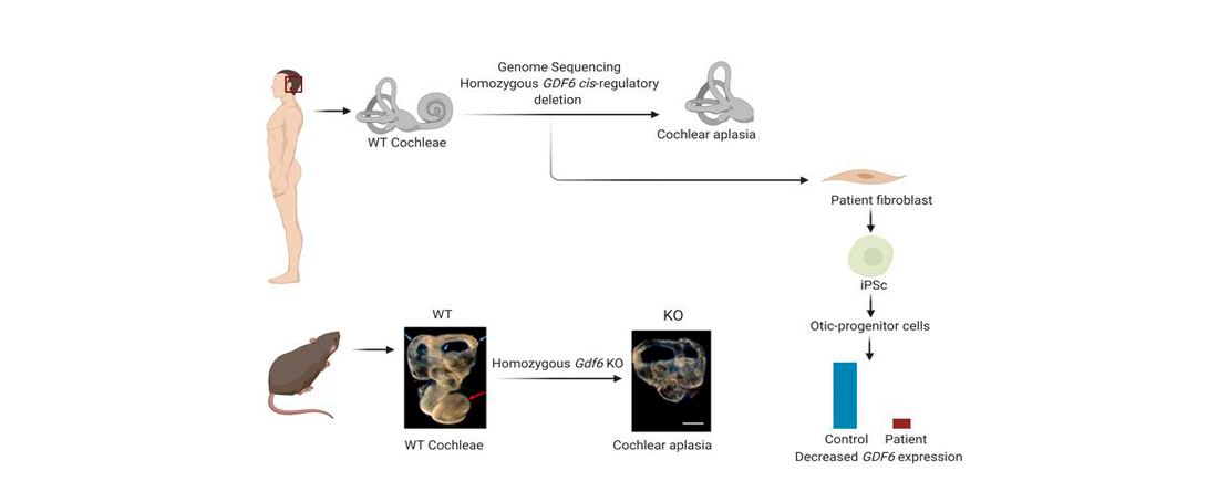 UM Researchers Discover Gene Involved in Early Cochlear Development ...