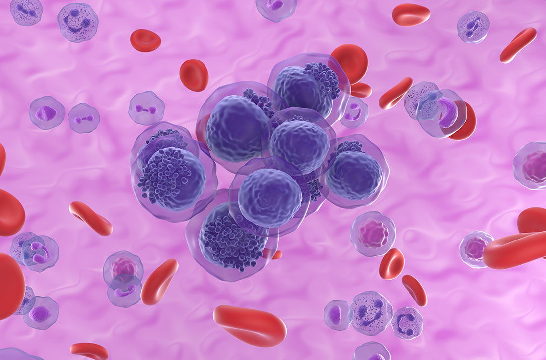 Study Could Lead to a New Combination Therapy Approach for Leukemia ...